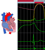 Heart Conduction